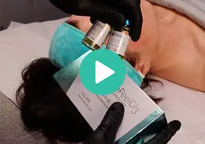 Video van BioRePeelCl3 behandeling